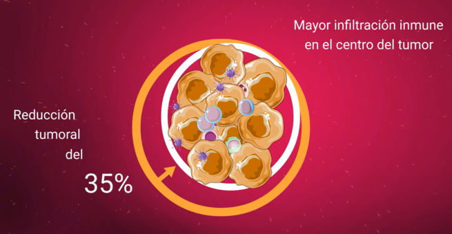 Efectos de Celyvir, el nuevo tratamiento que ha demostrado el efecto antitumoral de virus oncolíticos escondidos en células madre mesenquimales