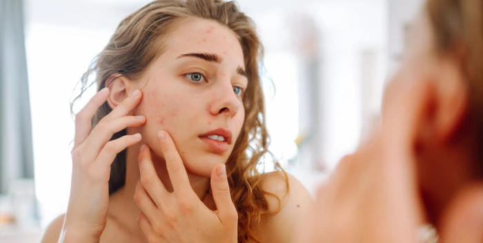 La relación entre la piel y las emociones