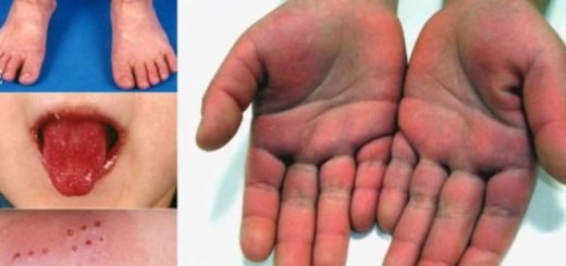 Imagen tomada de diario el Telegrafo