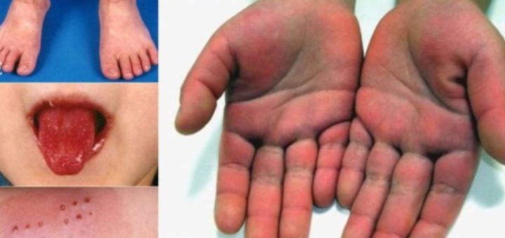 Imagen tomada de diario el Telegrafo